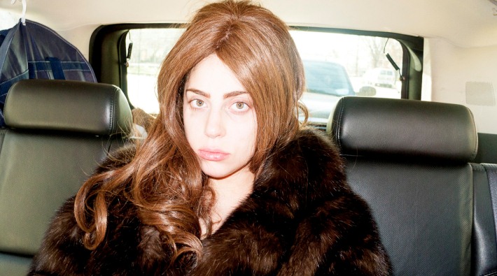 Lady Gaga será operada de una lesión en su cadera